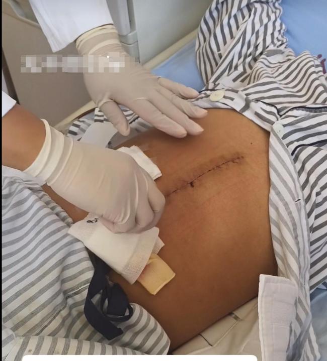 40天婴儿肝硬化00后父亲割肝救女 感动全网泪目瞬间