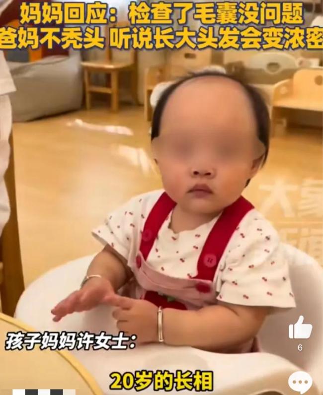 1岁女宝因前额秃被调侃像老干部：爸妈不秃头配资操盘炒股配资开户，听说长大头发会变浓密