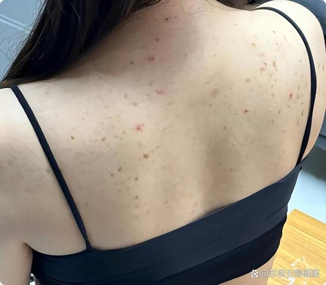 这6种证实其实是躯壳在喊“救命” 别淡薄这些求救信号