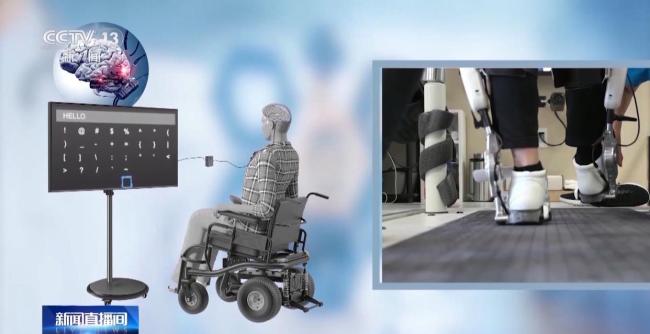 我國(guó)腦機(jī)接口技術(shù)走向臨床 受試者體驗(yàn)如何？