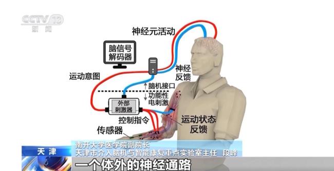 我国脑机接口技术走向临床 受试者体验如何？