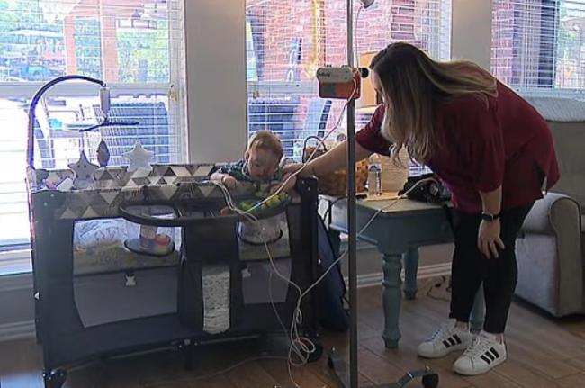 美国一名婴儿出生时脸部裂开 月底即将满周岁时接受手术