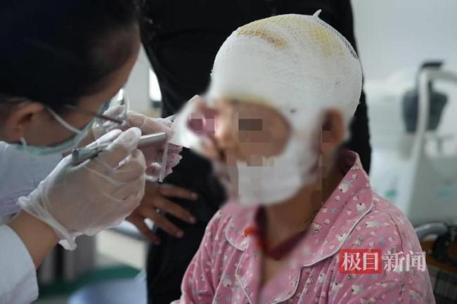 孕妇遭熊袭击重伤装死保命
