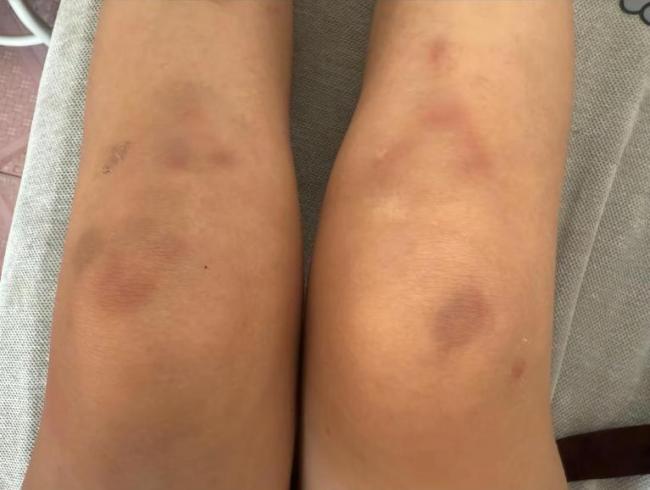 女子自称因工资问题被老板锁办公室里打 警方回应 涉事双方正在协调