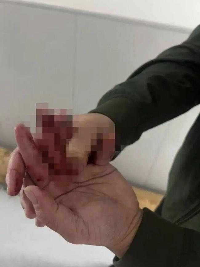 民警救车祸被困者时手指被车门夹断 英勇救援彰显担当