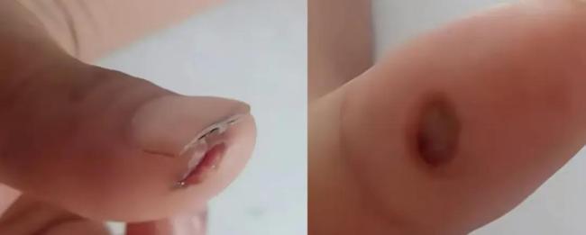 妻子抄起油桶砸向丈夫 网友一致好评 危急时刻果断施救