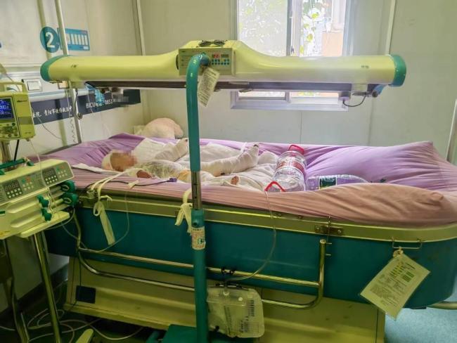 2岁女童意外跌入开水锅仍在ICU