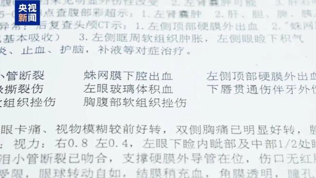好意让同事搭便车却发生车祸,车主要赔偿吗?