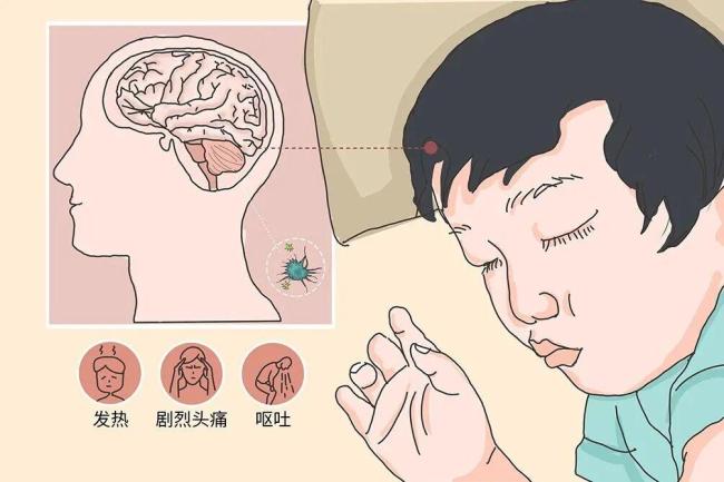 性情大变、出现幻觉,警惕得了这种病