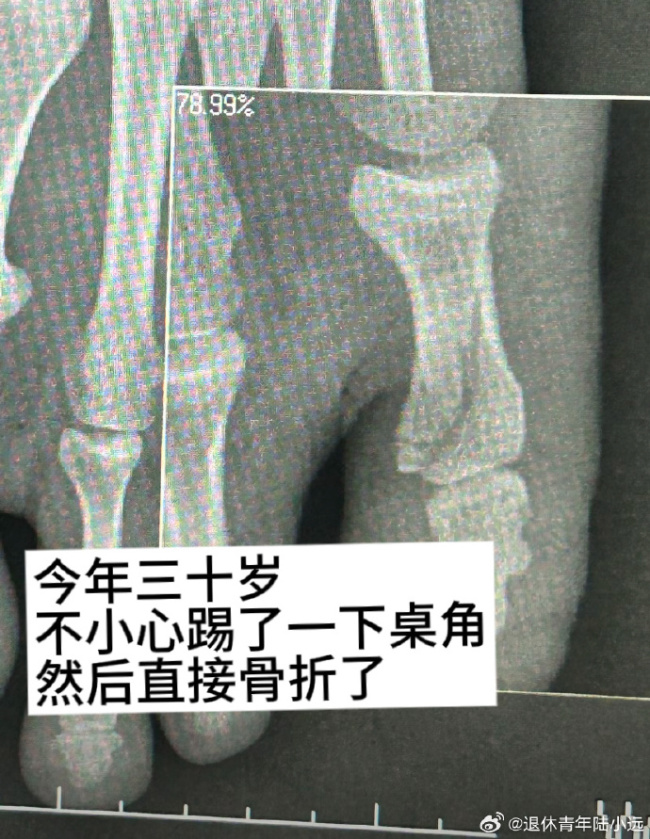 人到了三十岁就变得很脆皮！
