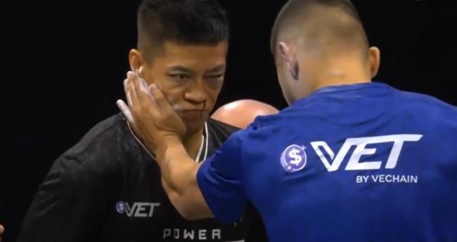 扇耳光大赛意义在哪