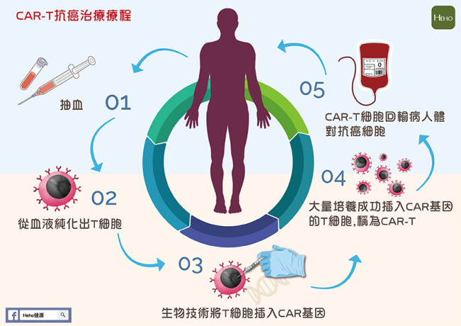 百万一针的抗癌药有望首次纳入商保 CAR-T疗法迎来转机