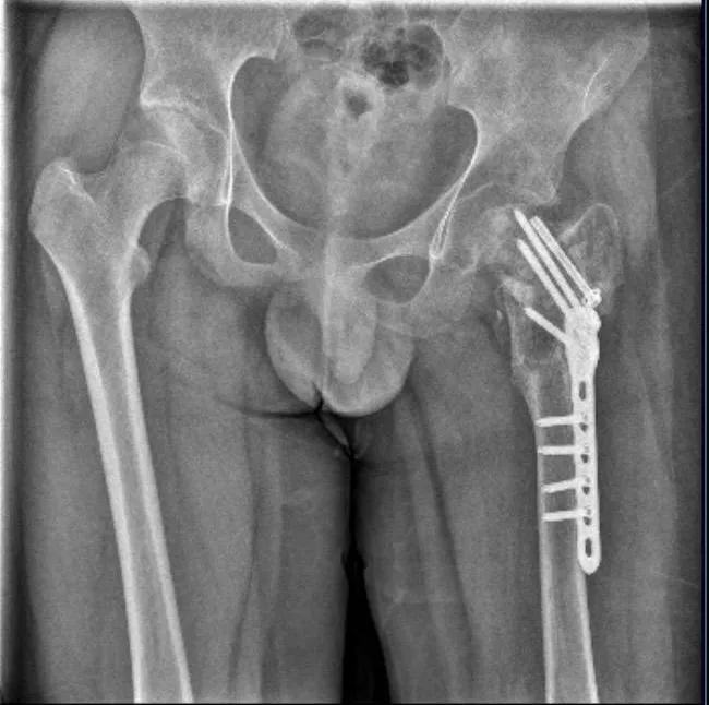 男孩被虐28天致重伤二级 成长基地背后的残酷真相