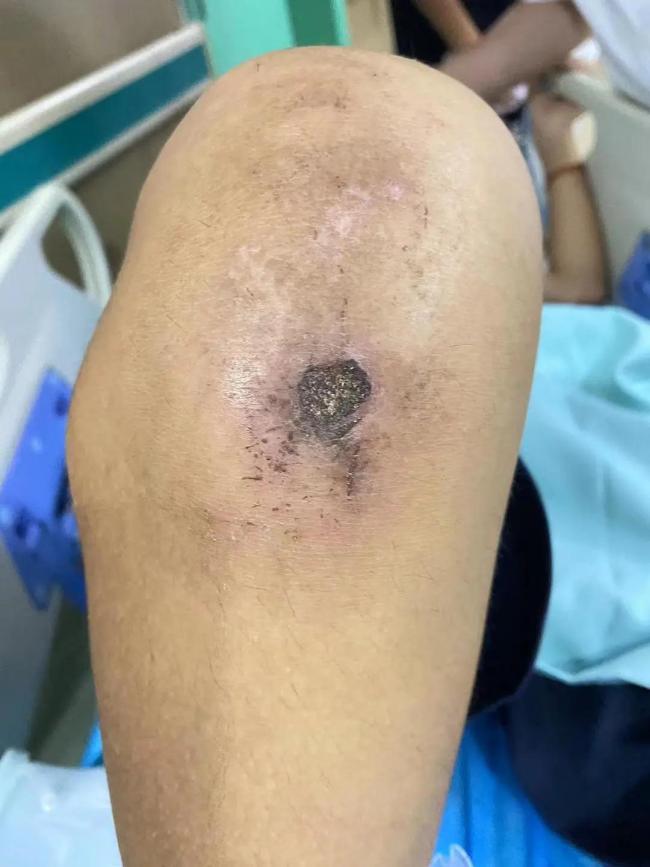 男孩被送矫正基地致半残疾 4人被起诉 虚假宣传的代价