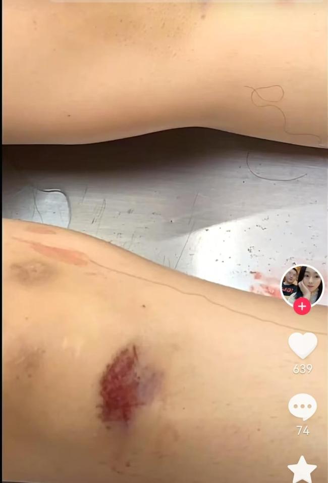 女子被车撞伤死亡 男友未打120 法院判男友无罪引发争议