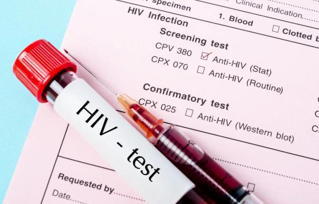 大三男生网络交友3个月感染艾滋病 年轻人群需警惕