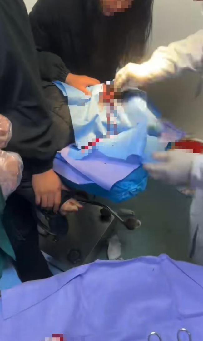 女子坐电瓶车摔倒 头被鲨鱼夹扎破 缝了9针!