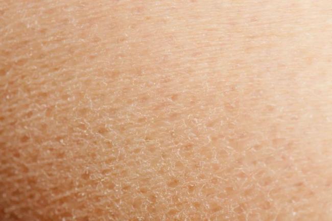 這樣洗澡當心越洗越癢！防手足皸裂必看