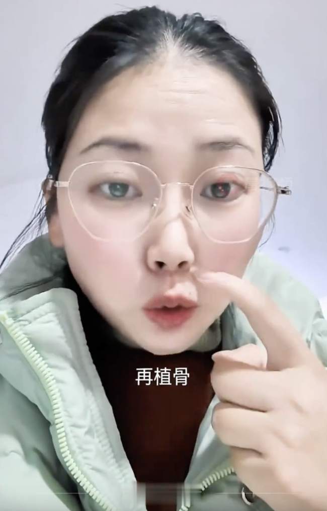 36歲寶媽生完二胎后患上嚴重牙周病