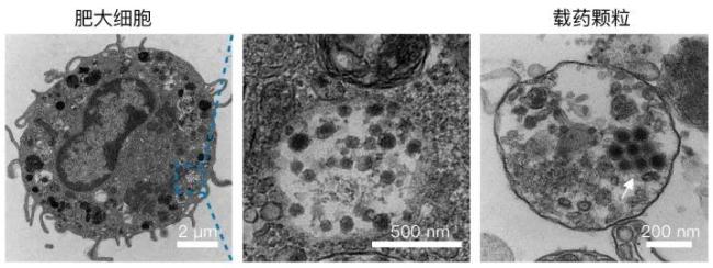 中國科學家發(fā)現(xiàn)抗癌“新利器” 過敏反應轉為抗癌武器