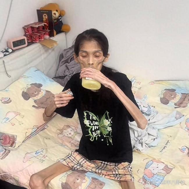 胃萎缩暴瘦至35斤女子去世 年仅27岁