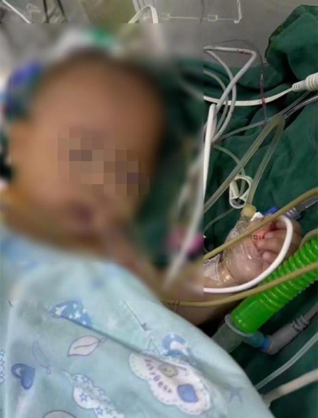 宁波妇儿医院儿胸心外科已处关闭状态 家属质疑手术指征