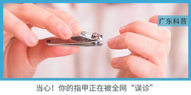 不跑不跳三个动作控血糖 间歇步行法稳血糖