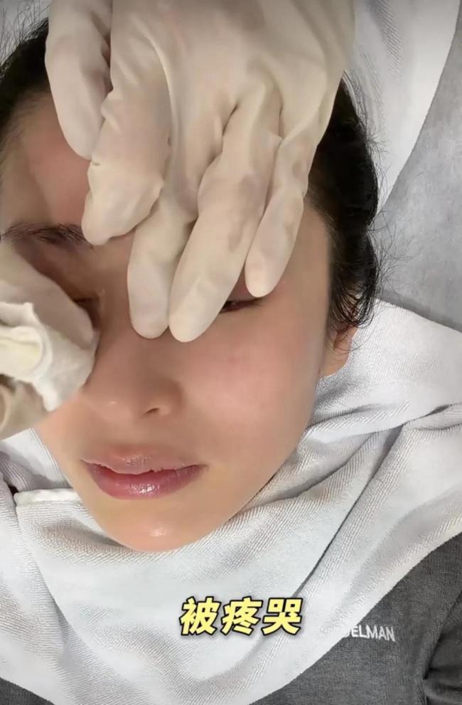 颖儿做眼部热玛吉疼哭了 明星的美丽代价