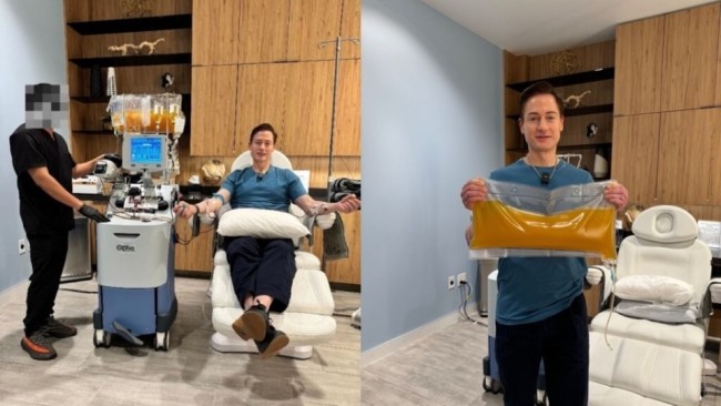 硅谷富豪“三代换血” 科学照旧哲学 换血抗衰靠谱吗？