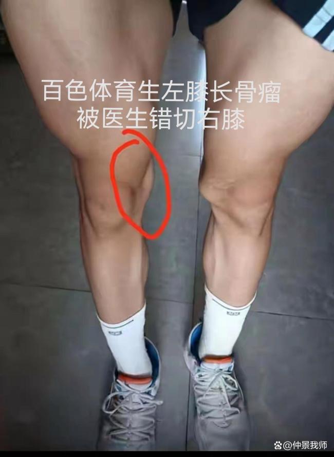 左脑开错刀是手术安全流程的全面失守 医疗失误频发警钟长鸣