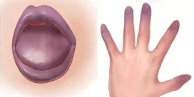 以为能吃其实可能“有毒”的食物 警惕这些隐藏风险