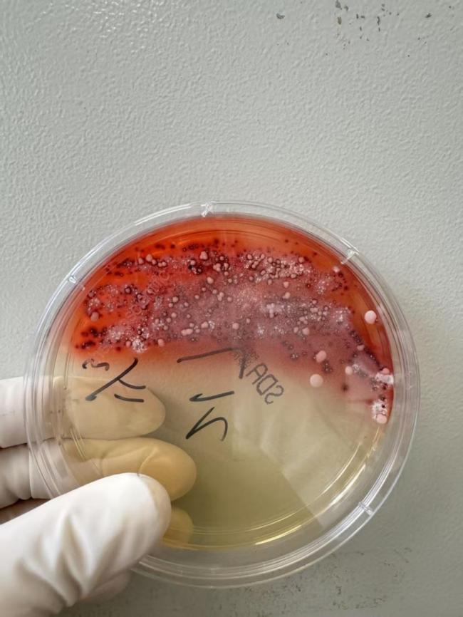 这种致癌物藏在家里 许多东谈主浑然不知 霉菌挟制健康
