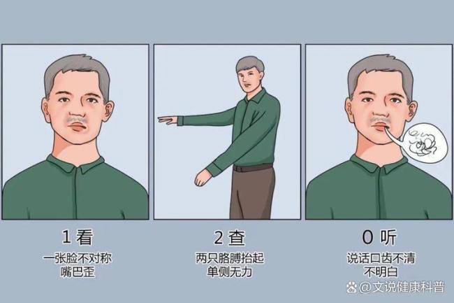 120不仅是急救电话也是救命口诀 中风识别与自救秘籍