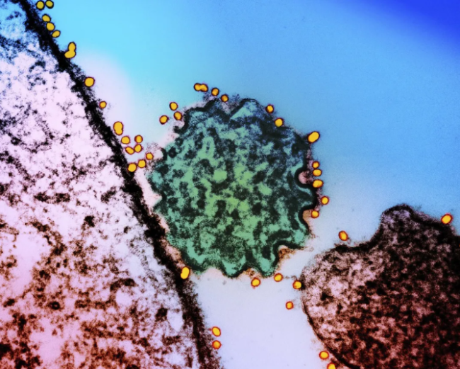 “致命尼帕”会全球流行吗?该如何防护?