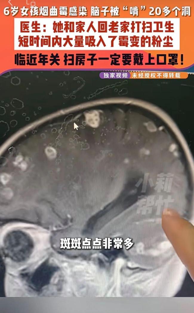 “年前大扫除”藏着哪些健康风险 霉菌威胁需警惕