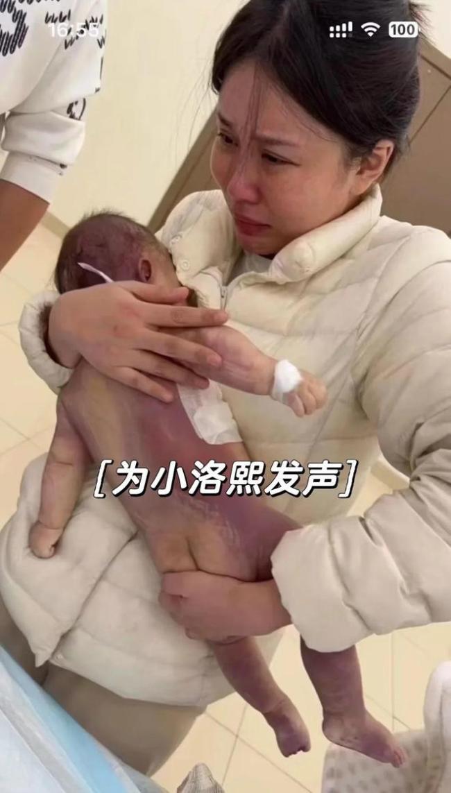 小洛熙事件为一级甲等医疗事故 医方负主要责任