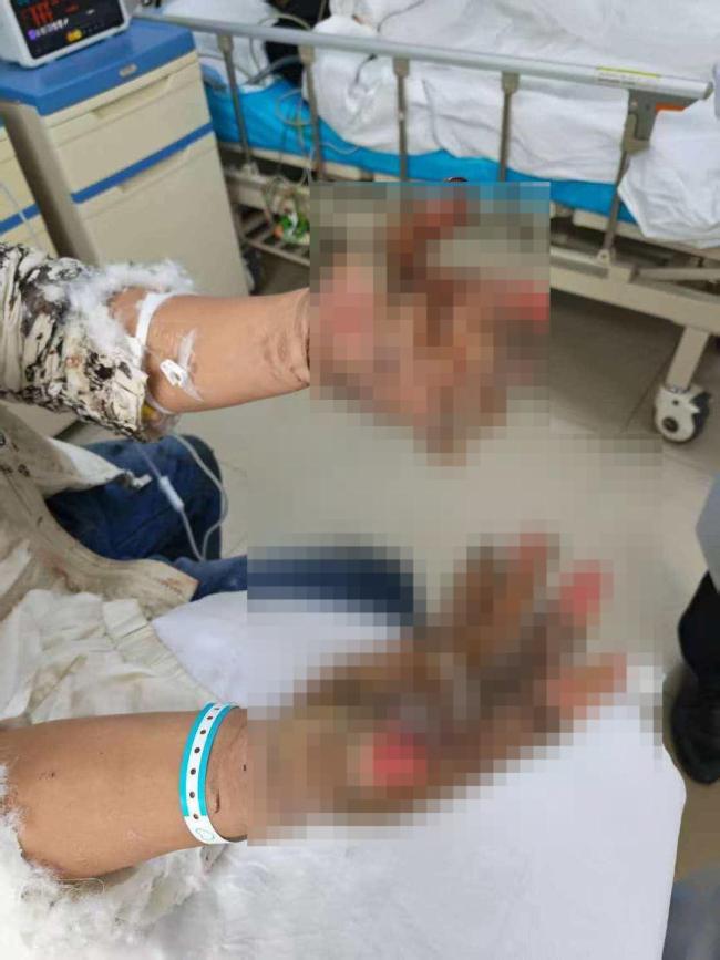 从起火车中救出3人男子系过错方 申请见义勇为未通过