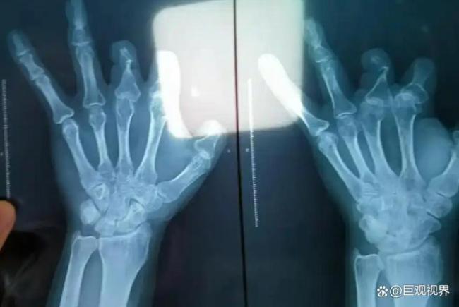 郑大一附院医生两罪并罚获刑 黑心敛财300多万