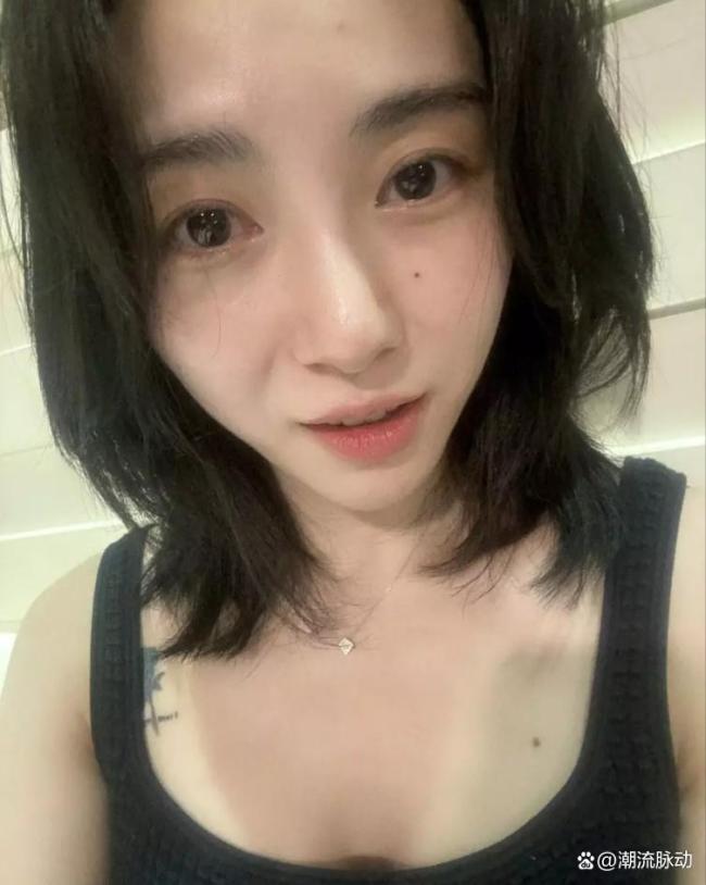 权珉娥医好意思后毁容 医好意思事故激发烧议