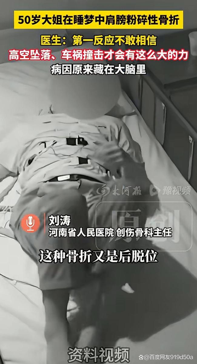 50岁大姐在睡梦中粉碎性骨折