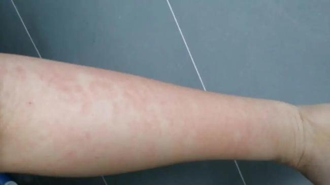 官方通报袋鼠妈妈被曝虚假宣传