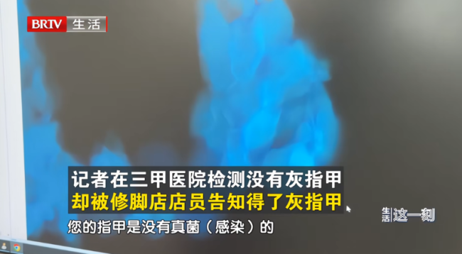郑远元称猥亵顾客男技师已被开除 涉事门店回应赔偿问题