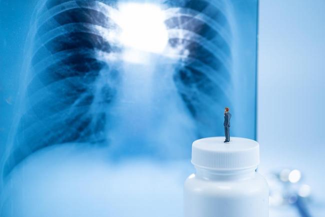 这4种癌症早期筛查真的有用 科学防癌早知道