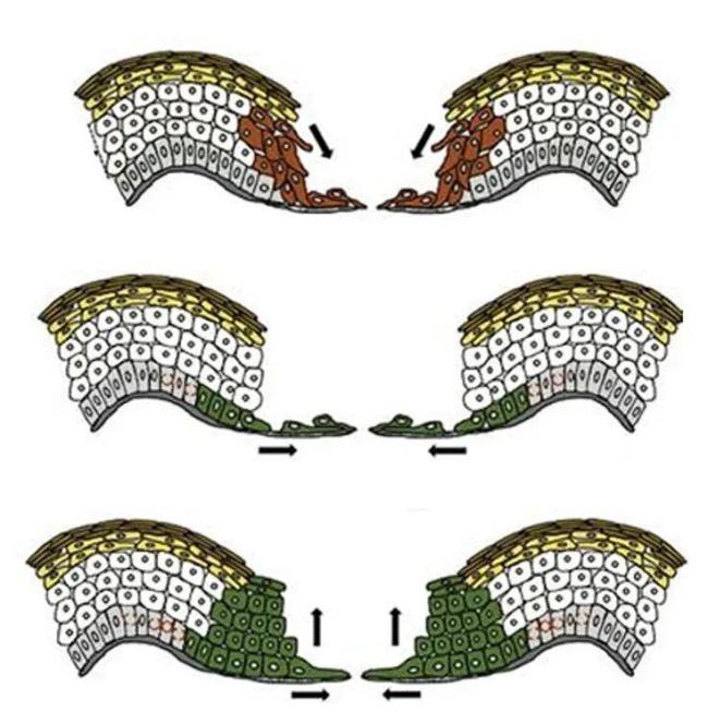 伤口“晾干”好还是“保湿”好