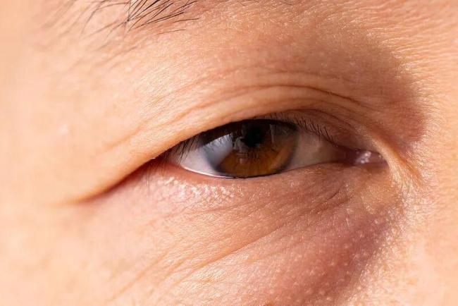 眼睛出现这两类情况要立刻就医 突发视力下降需警惕