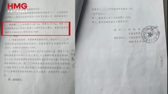 湖南姐弟遭继母生父刻毒细节曝光 狂暴活动令东谈主发指