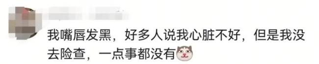 三甲医生回应为什么会有人嘴唇发紫 警惕身体预警信号