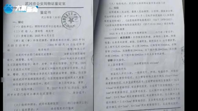 湖南一对姐弟遭生父继母虐待 满身伤痕触目惊心