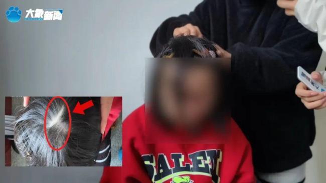 咸宁姐弟遭生父继母虐打 悲惨遭遇曝光