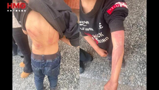 男孩遭继母虐待 求生母不要再婚 残忍虐待震惊社会